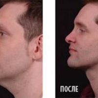 МАСАЖОР ПРОТИВ ДВОЙНА БРАДИЧКА "Neckline Slimmer" – снимка 4