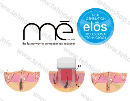 ФОТОЕПИЛАТОР "ME MY ELOS TOUCH" - 150 000 ДОЖИВОТНИ ИМПУЛСА